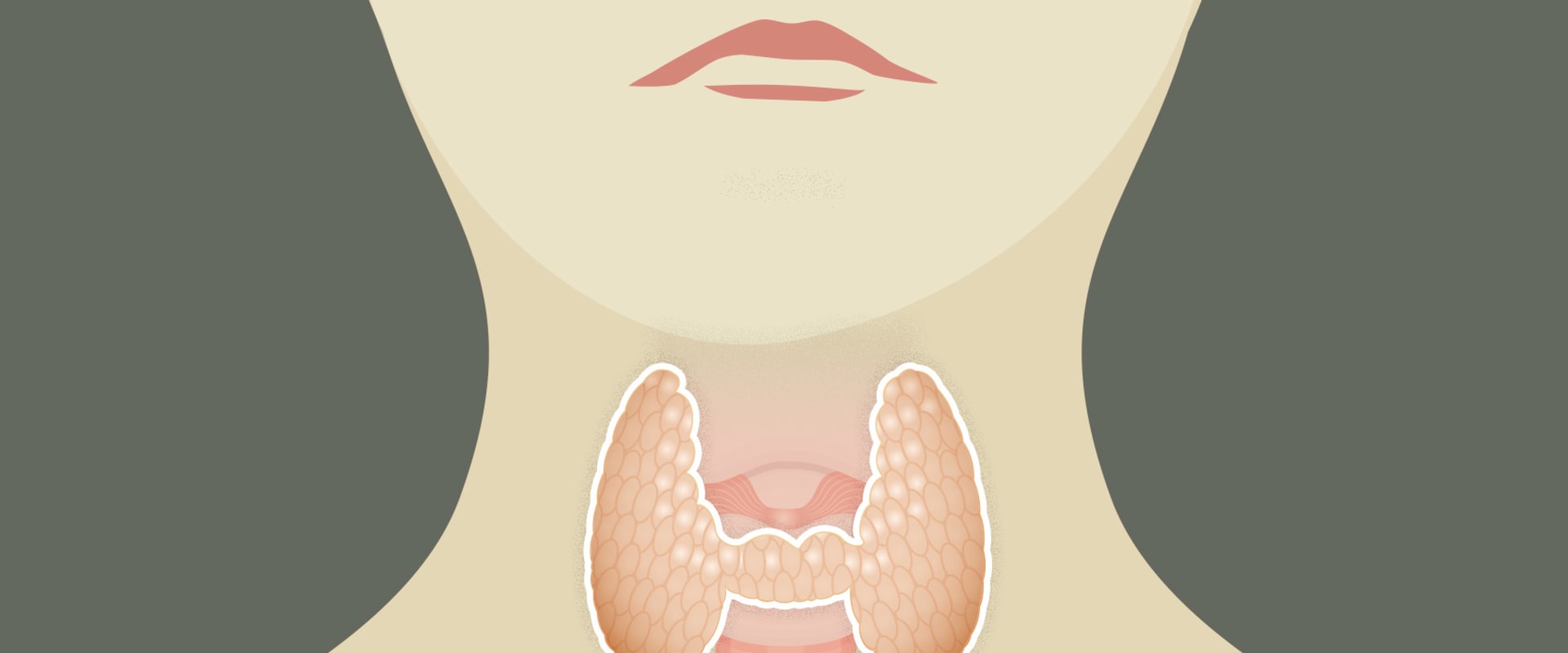 frontiers-use-of-levothyroxine-in-the-management-of-hypothyroidism-a